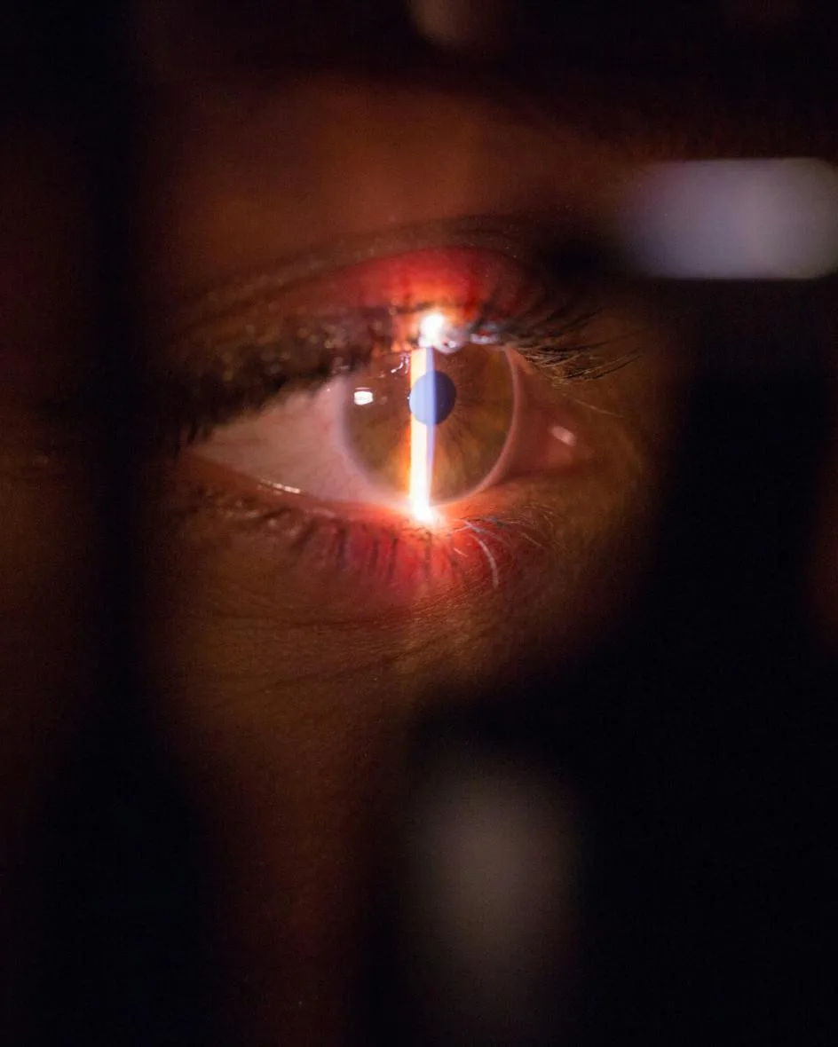 Slit-lamp light beam crossing a human eye during an ophthalmic exam, an everyday use of optics and photonics.